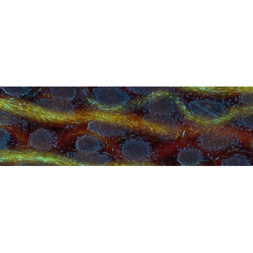 Köhler Illumination